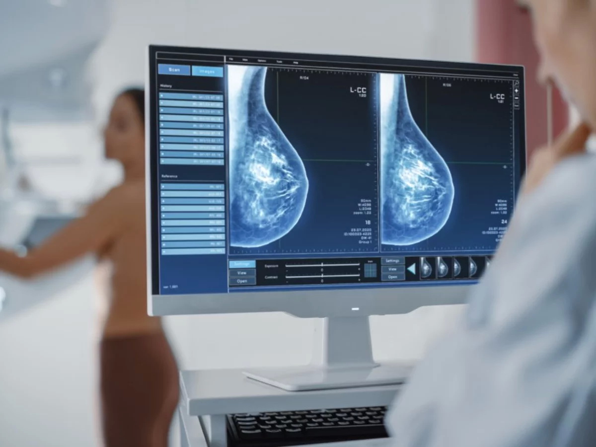 Más de 387.000 mujeres andaluzas han participado en el cribado de cáncer de mama de enero a octubre