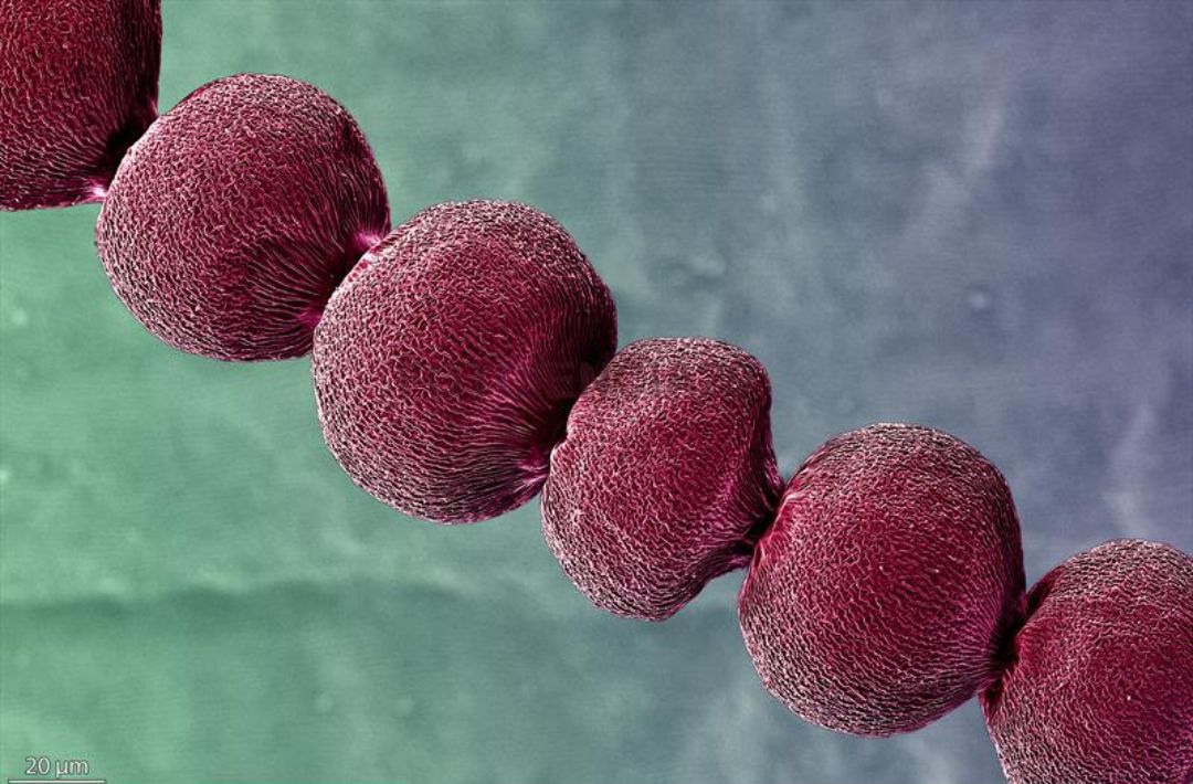 El primer premio FOTCIENCIA en la categora Micro recae, por quinto ao consecutivo, en tres cientficas de la UGR