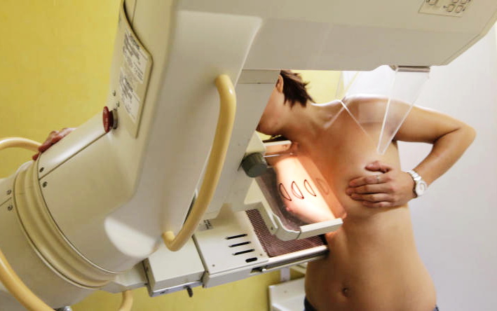 Más de 131.370 mujeres de entre 50 y 69 años se benefician del Programa de Detección Precoz de Cáncer de Mama